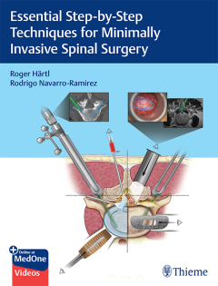 Essential Step-by-Step Techniques for Minimally Invasive Spinal Surgery