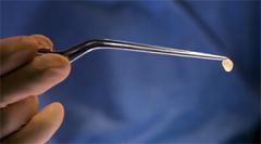 colloid cyst 