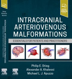 Intracranial Arteriovenous Malformations, Essentials for Patients and Practitioners 