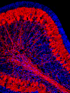 In this sagittal section of the cerebellum, a common location for ATRT and medulloblastomas, the red indicates Purkinje neurons; nuclei are in blue.